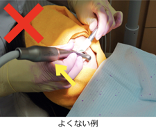 ハンドピースのモーター部分をむき出しで使っています