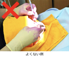 歯科の感染予防と、グローブ交換1