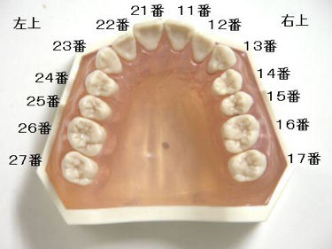 FDI方式1